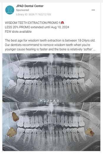 Facebook ads for dentists, example ad with time-sensitive promotion