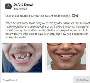 A great dental ad example with patient’s before and after images